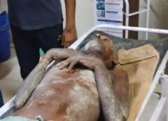 Raybareli News: छत से नीचे गिरकर वृद्ध, हुआ गंभीर रूप से घायल।